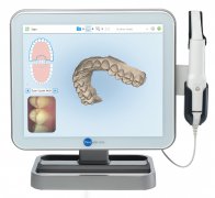 iTero��ǻ����x���v�ۿ�����3������mȡģ